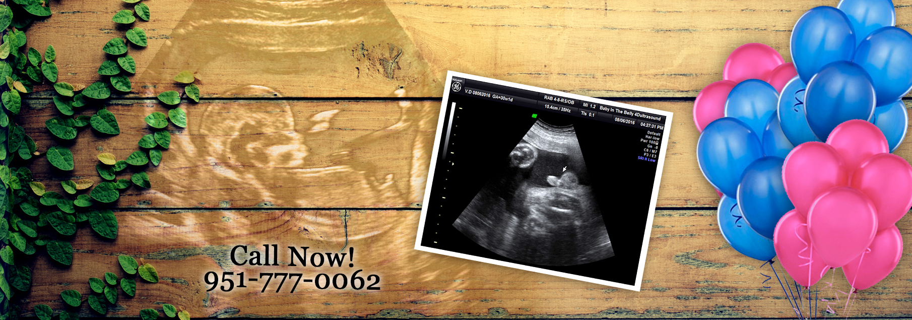 Ultrasound Gender Reveal Session Only $37