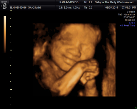 3d Ultrasound 4d Ultrasound Baby In The Belly