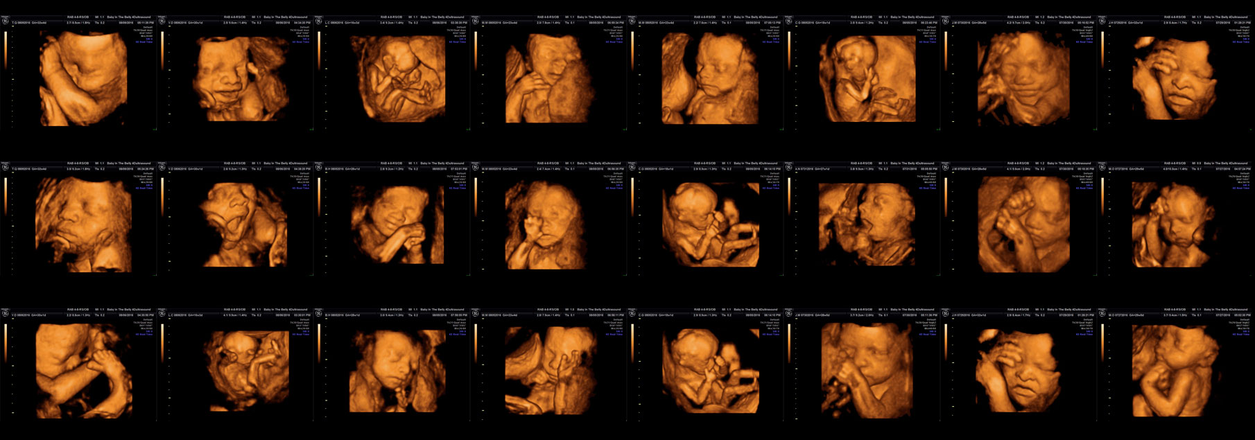 prenatal-ultrasound - Baby in the Belly.