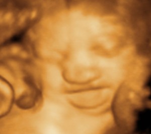 3D / 4D  Ultrasound Image