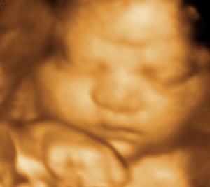 3D / 4D  Ultrasound Image