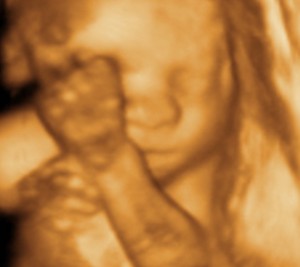 3D / 4D  Ultrasound Image