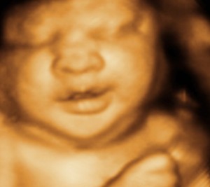 3D / 4D  Ultrasound Image