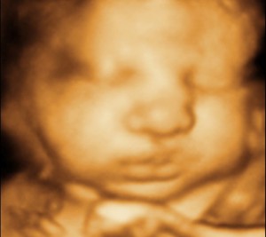 3D / 4D  Ultrasound Image