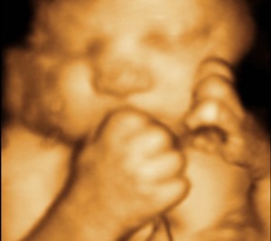 3D / 4D  Ultrasound Image