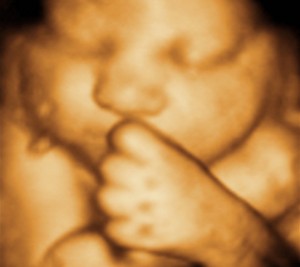 3D / 4D  Ultrasound Image