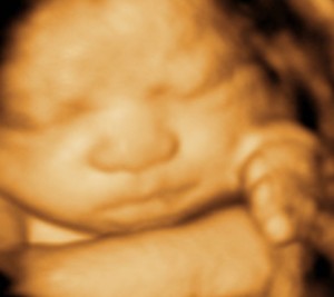 3D / 4D  Ultrasound Image