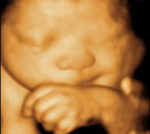 3D / 4D  Ultrasound Image