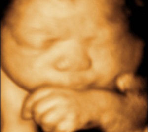 3D / 4D  Ultrasound Image