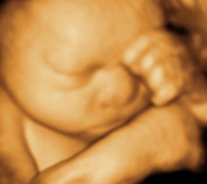 3D / 4D  Ultrasound Image