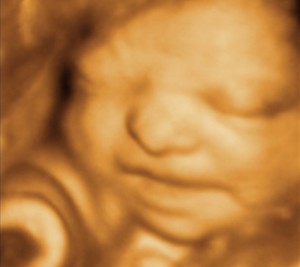 3D / 4D  Ultrasound Image