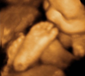 3D / 4D  Ultrasound Image