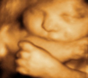 3D / 4D  Ultrasound Image