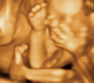 3D / 4D  Ultrasound Image