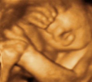 3D / 4D  Ultrasound Image