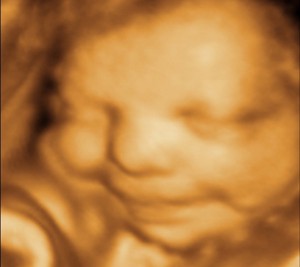 3D / 4D  Ultrasound Image