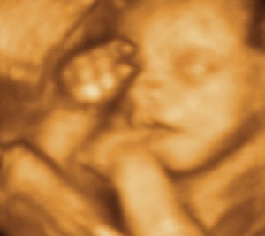 3D / 4D  Ultrasound Image