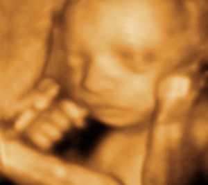 3D / 4D  Ultrasound Image