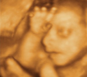 3D / 4D  Ultrasound Image