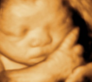 3D / 4D  Ultrasound Image