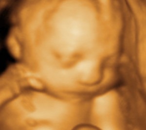 3D / 4D  Ultrasound Image