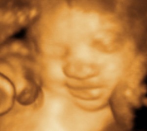 3D / 4D  Ultrasound Image